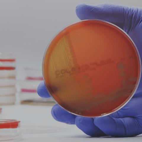 Control de Calidad y Seguridad Alimentaria
